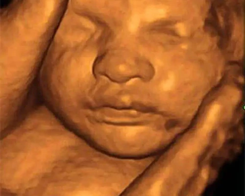 Patient undergoing abdominal sonography ultrasound scan