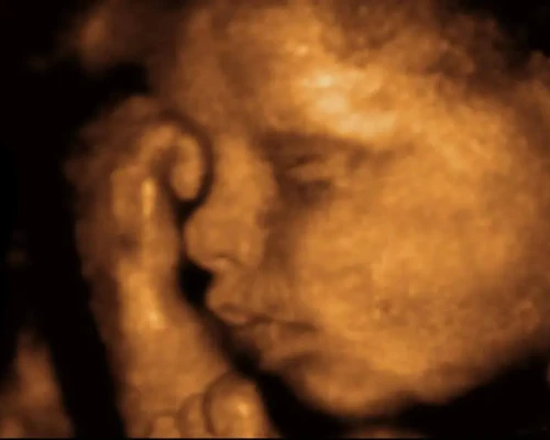 Advanced 3D 4D ultrasound sonography machine