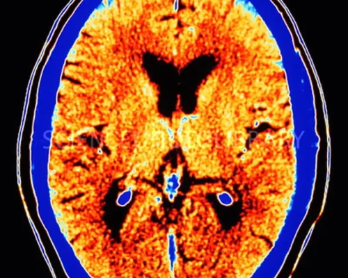 Advanced CT Scan Procedure at Arihant Diagnostic Centre