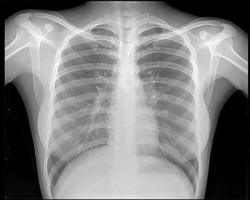 Bone Density and Fracture X-Ray Examination