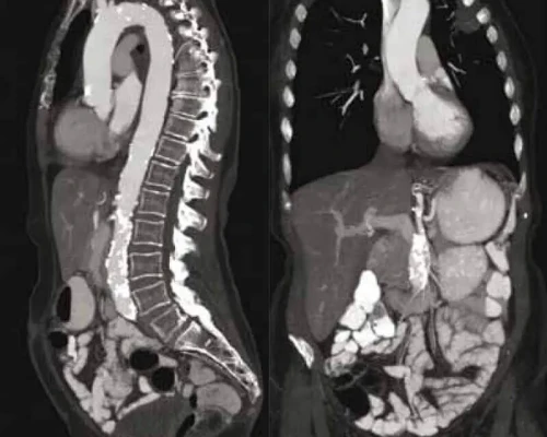 CT Scan Radiology Services at Arihant Diagnostic Centre