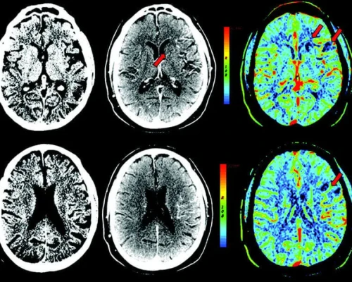 Diagnostic CT Scan Imaging at Arihant Diagnostic Centre