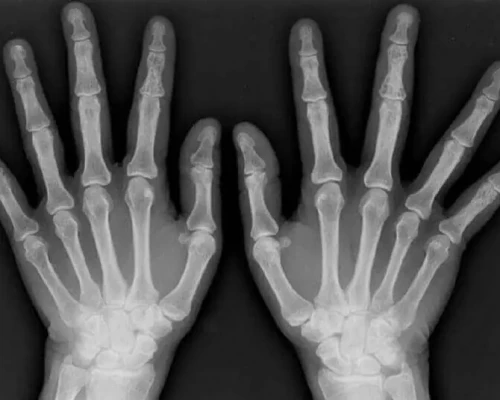 High Precision Digital X-Ray Report Results