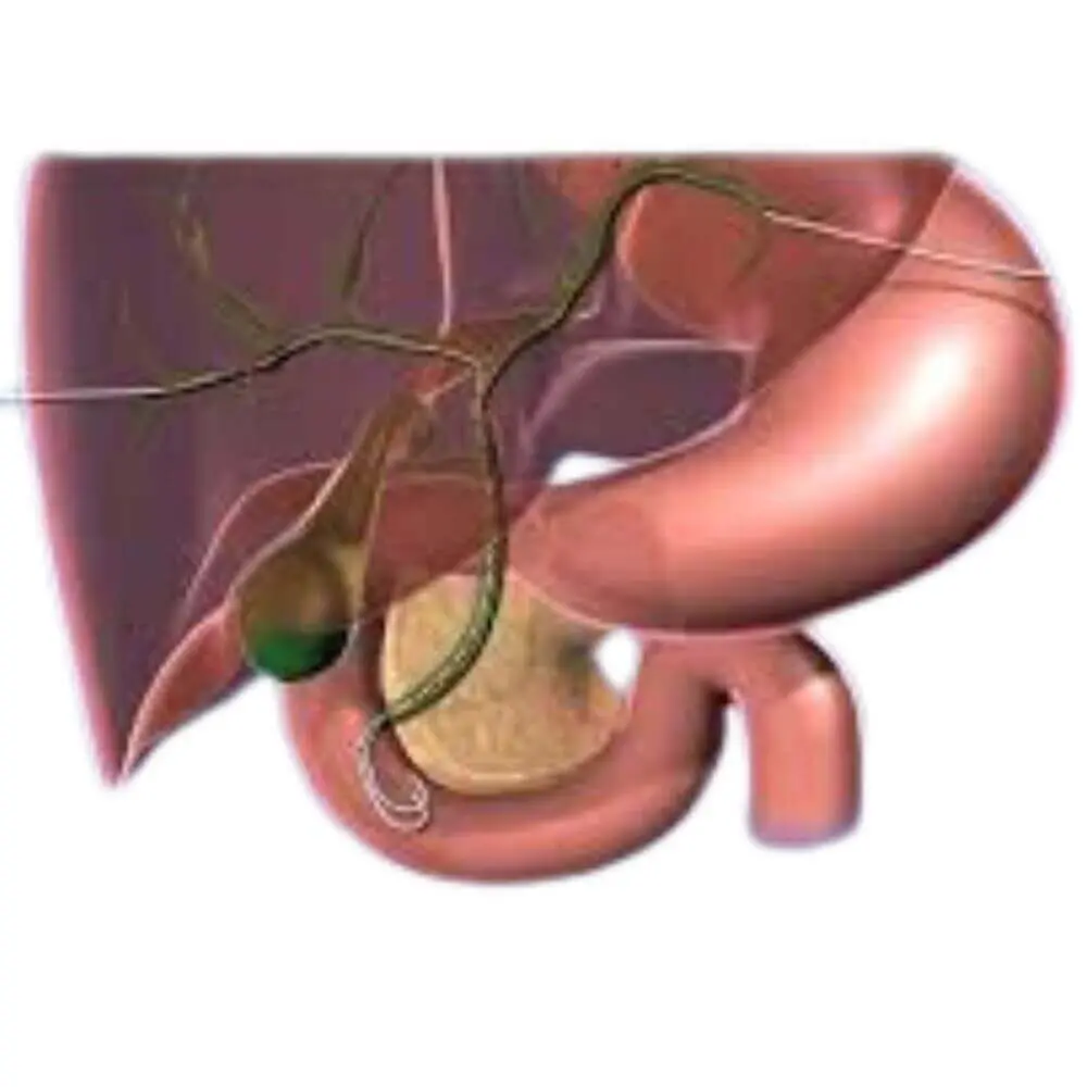 Gastrointestinal interventional treatment scan