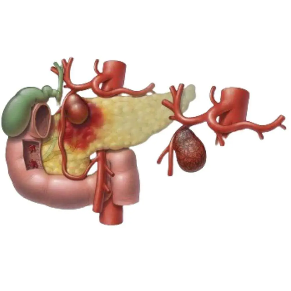Advanced gastrointestinal radiology intervention