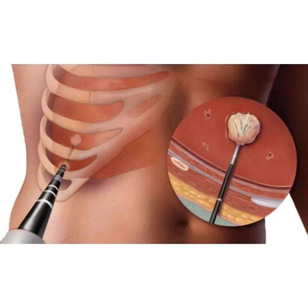 Gastrointestinal interventional radiology examination