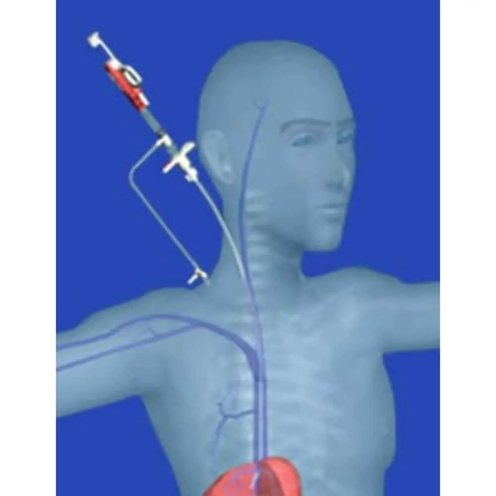Gastrointestinal interventional radiology diagnosis