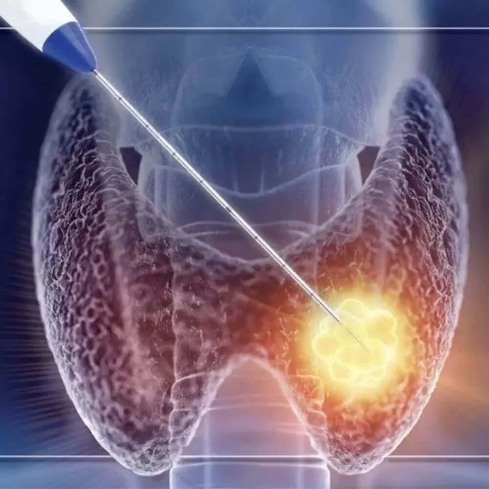 Head and neck interventional radiology diagnostic image