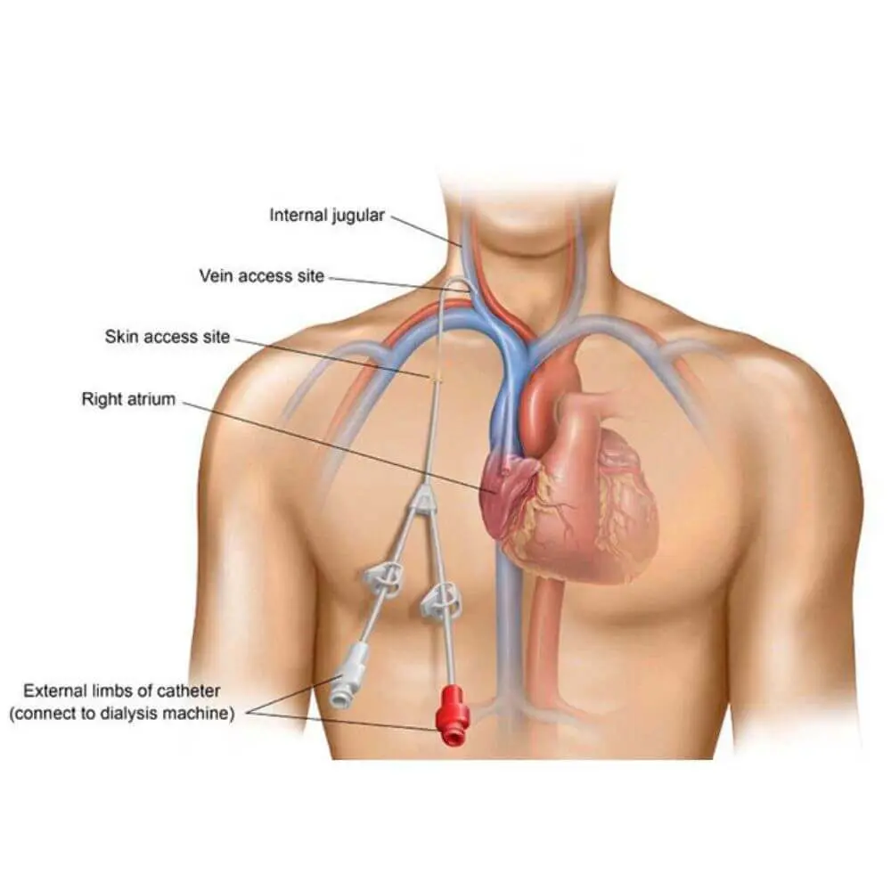 Interventional radiologist performing image guided procedure