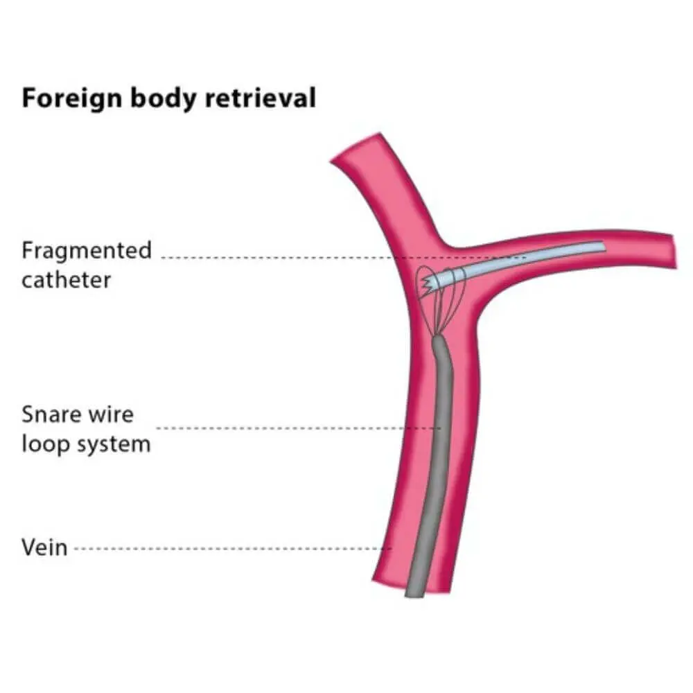 Minimally invasive interventional radiology treatment setup