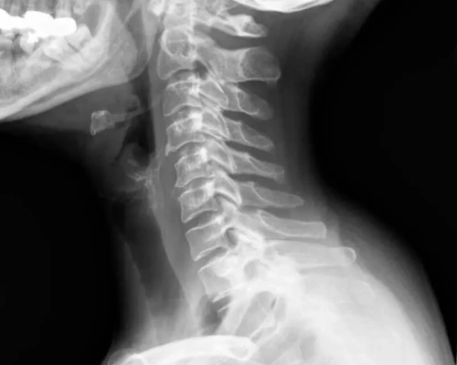 Modern Digital Radiography X-Ray Machine