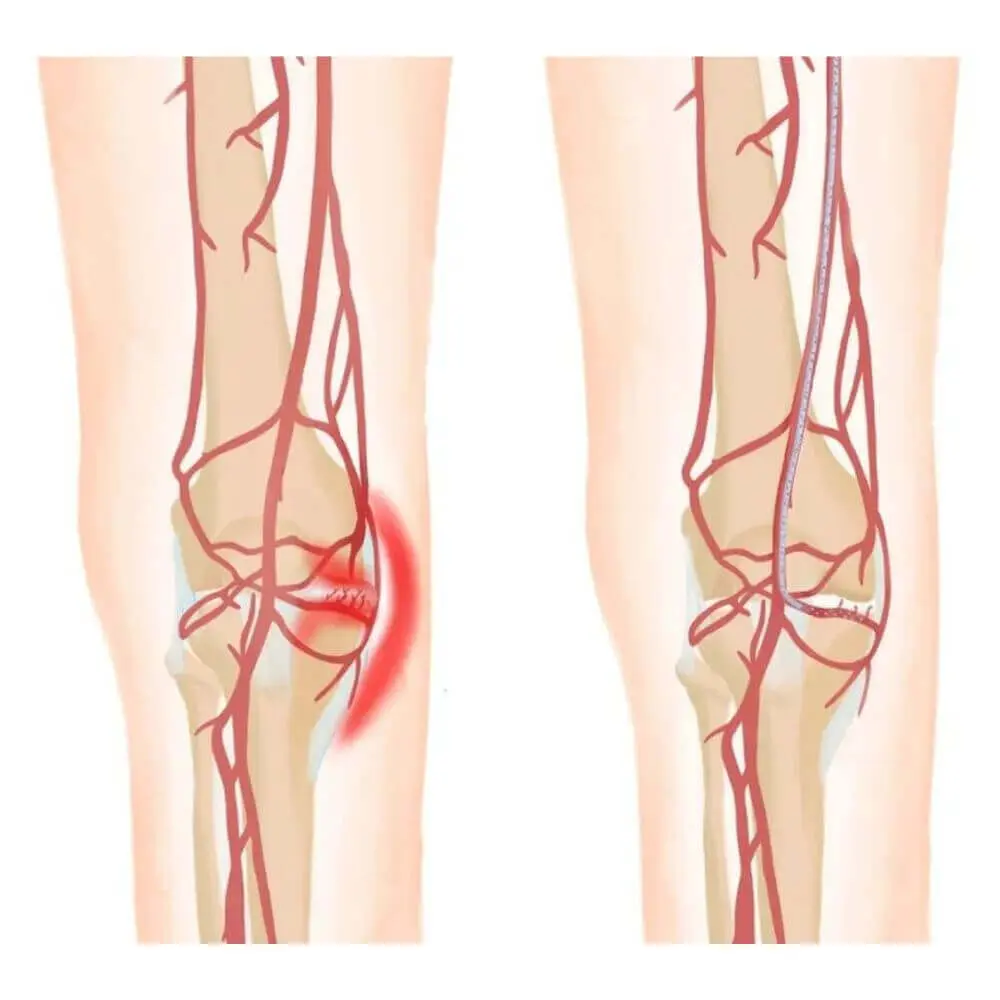 Musculoskeletal interventional radiology imaging