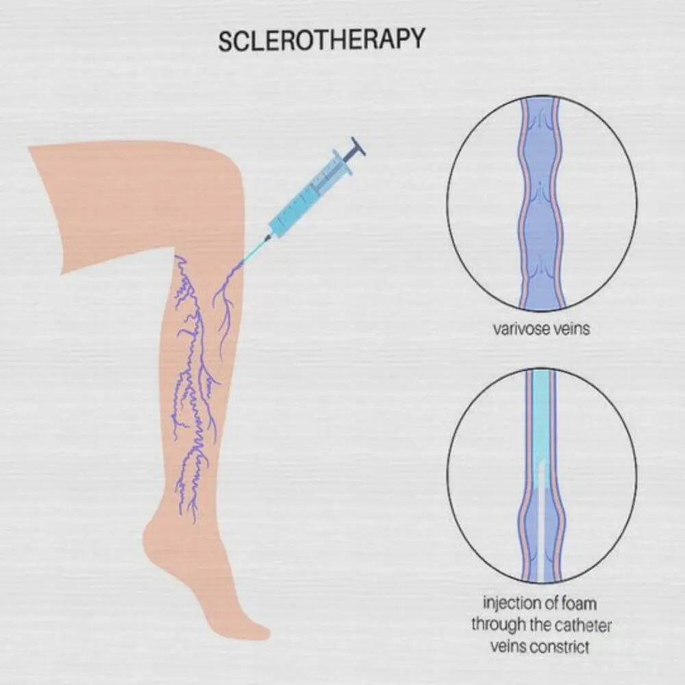 Musculoskeletal interventional radiology examination