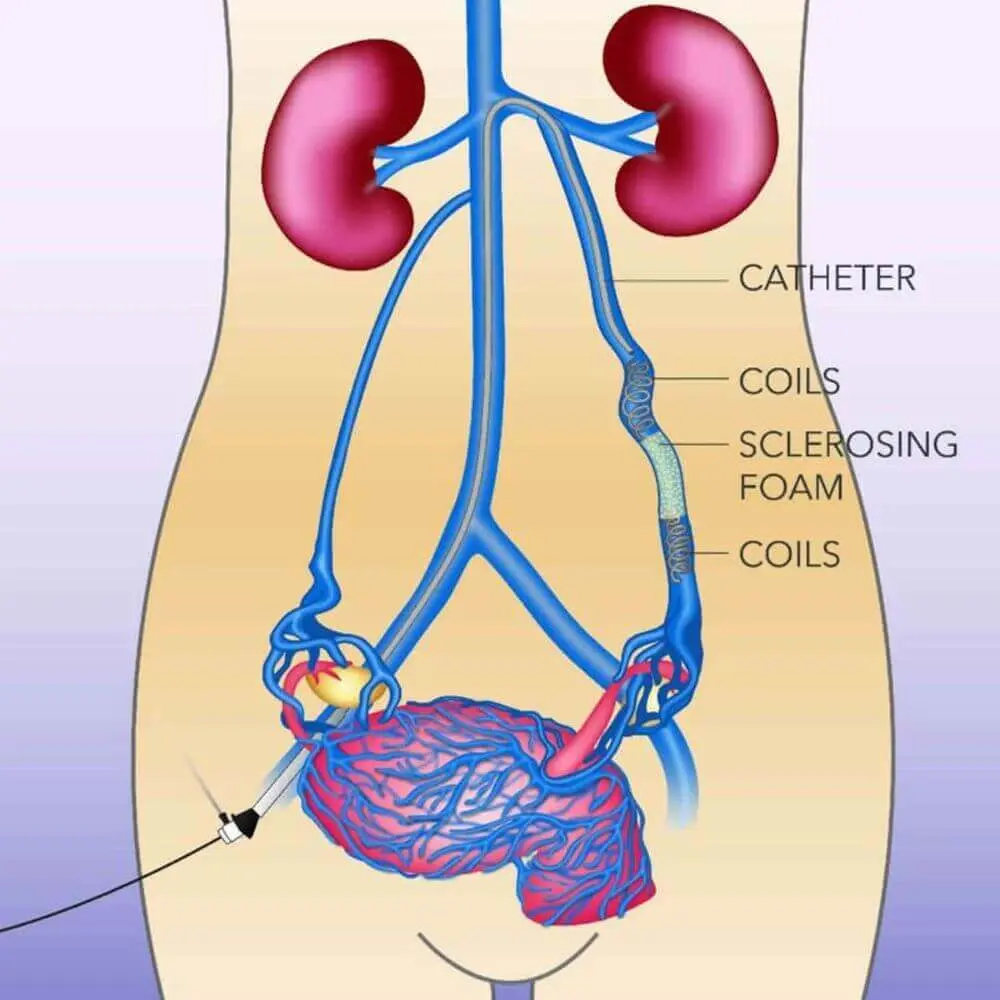 Obstetric interventional radiology imaging
