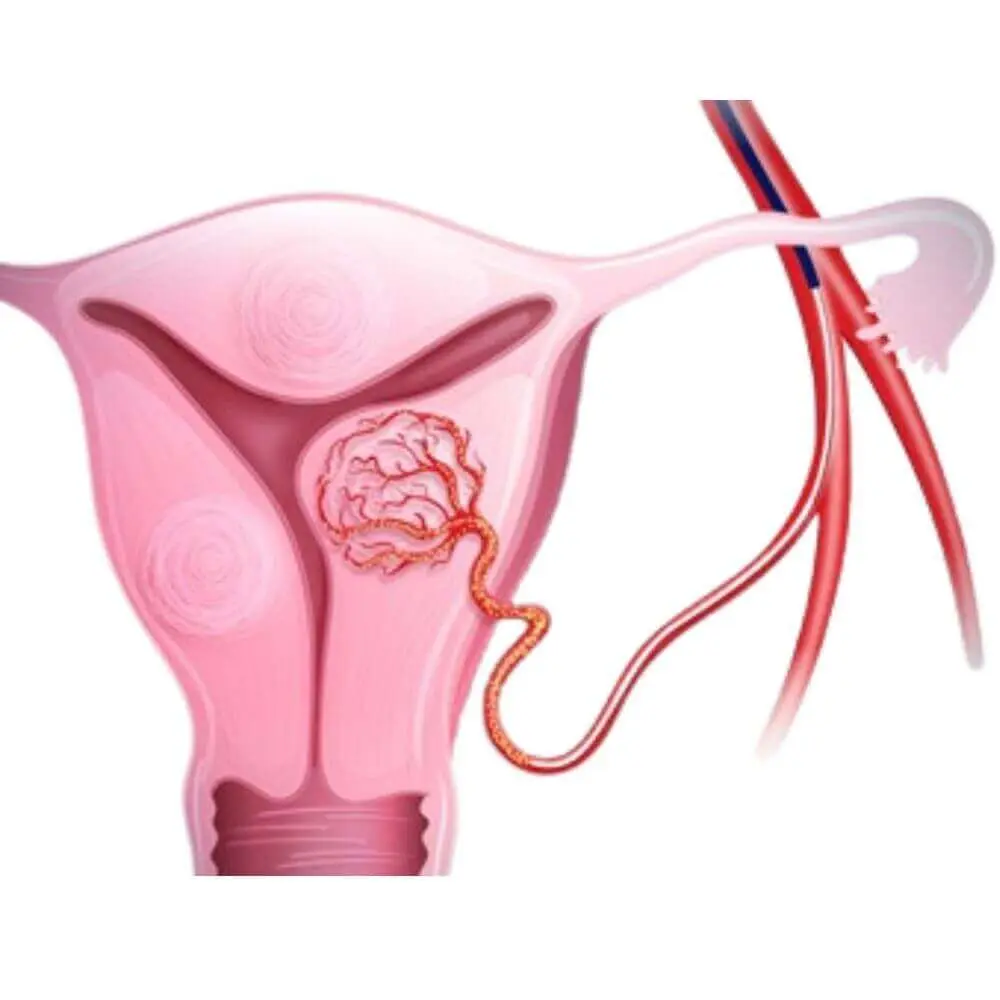 Obstetric interventional radiology examination scan