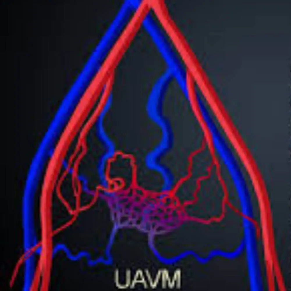 Advanced obstetric interventional radiology care