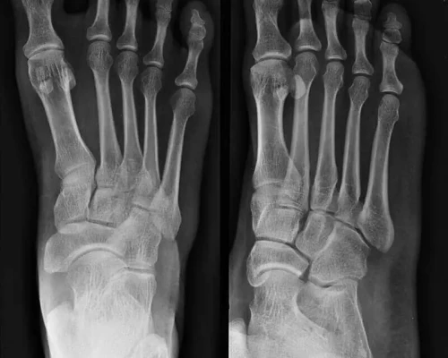 Patient Undergoing X-Ray Scan at Arihant Imaging Centre