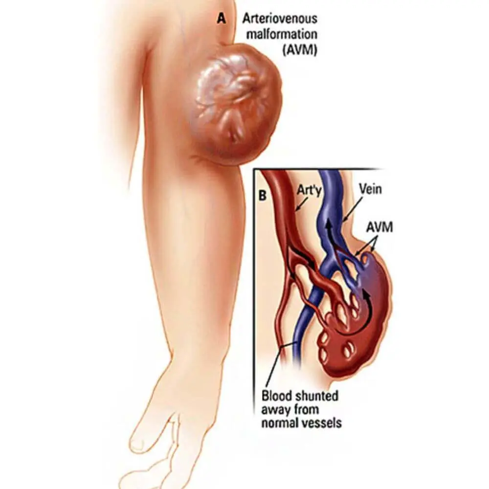 Peripheral vascular interventional radiology imaging