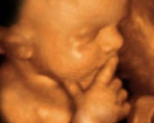 Obstetric pregnancy sonography ultrasound testing service