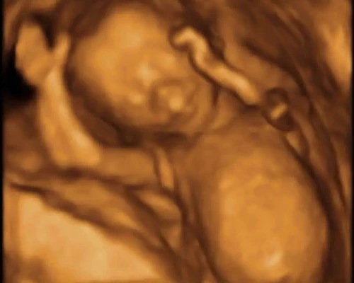 Doctor reviewing sonography scan diagnostic imaging report