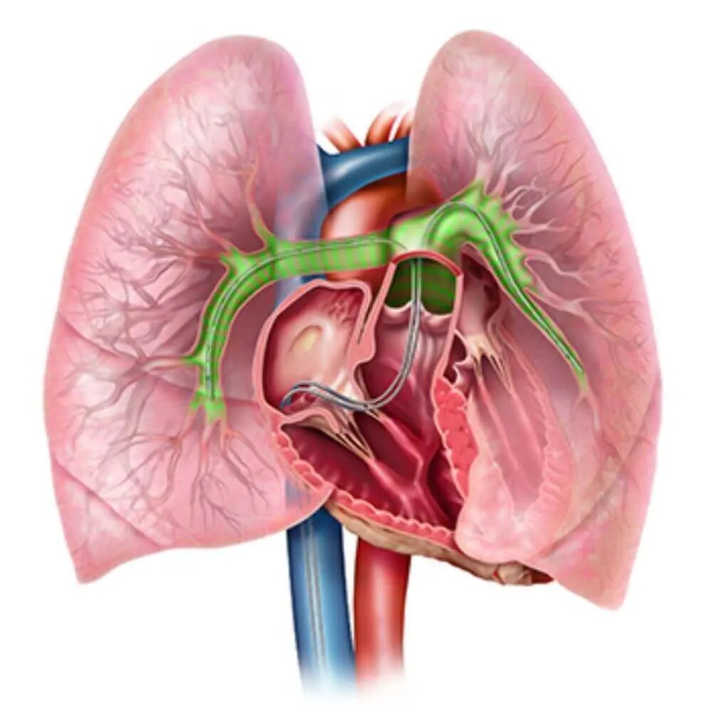Thoracic interventional radiology scan and diagnosis