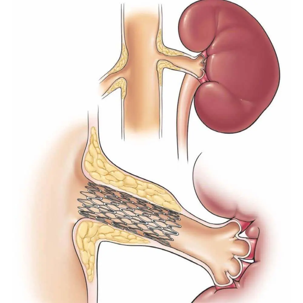 Urological interventional radiology imaging