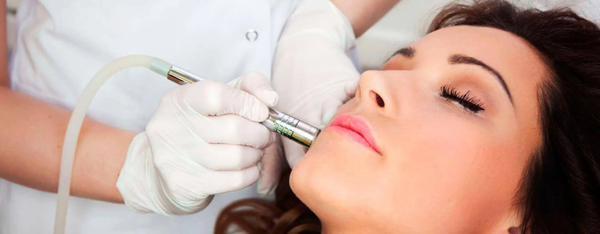 Laser Acne Scar Removal