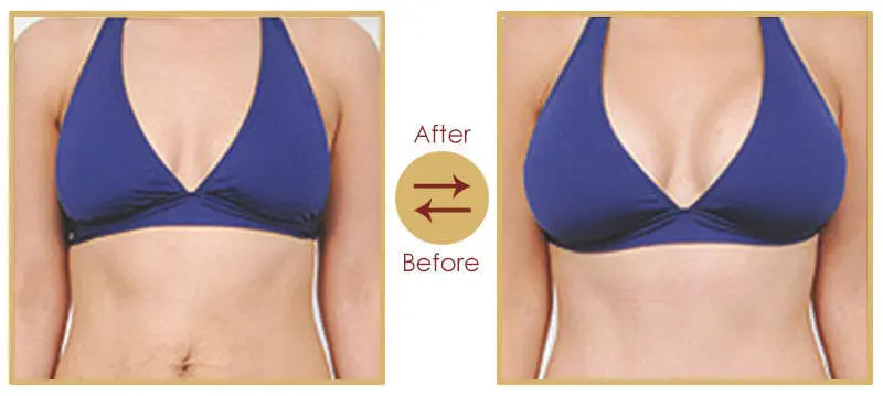 Aesthetic Shape Up Body Sculpting Consultation