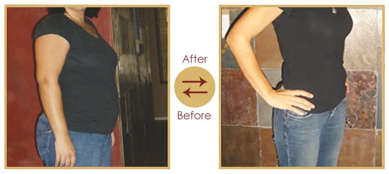 Personalized Aesthetics Diet Counselling Consultation
