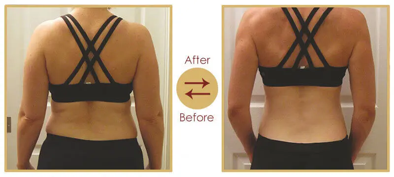Customized Nutrition and Diet Plan for Aesthetic Wellness