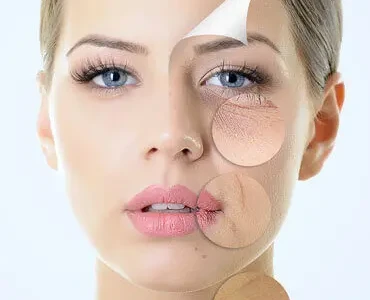 Cosmetic Surgery of Face