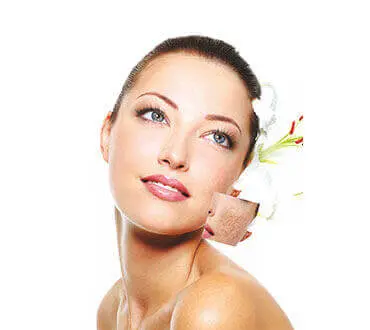 Laser acne scars treatment at Arihant Centre